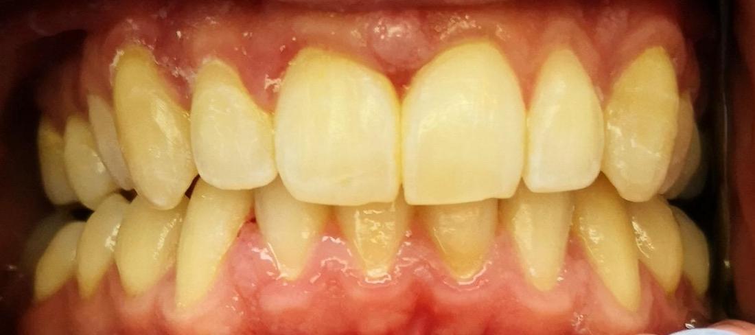Spark Dentist Dentists Nutley NJ