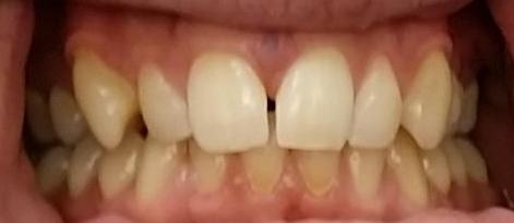 Spark Dentist Dentists Nutley NJ