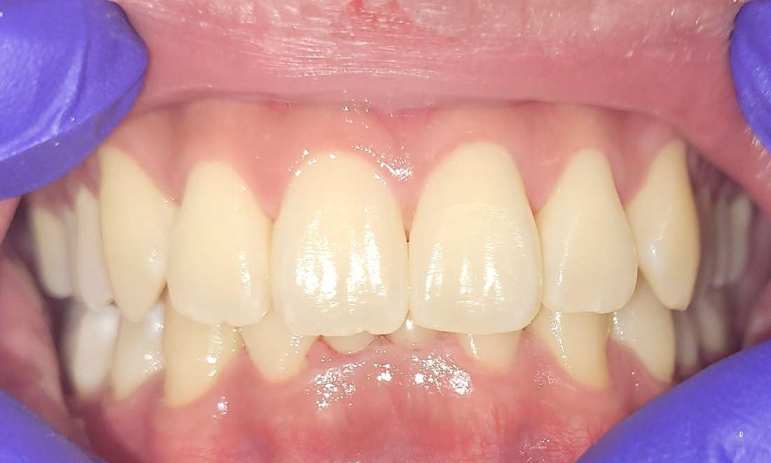 Spark Dentist Dentists Nutley NJ