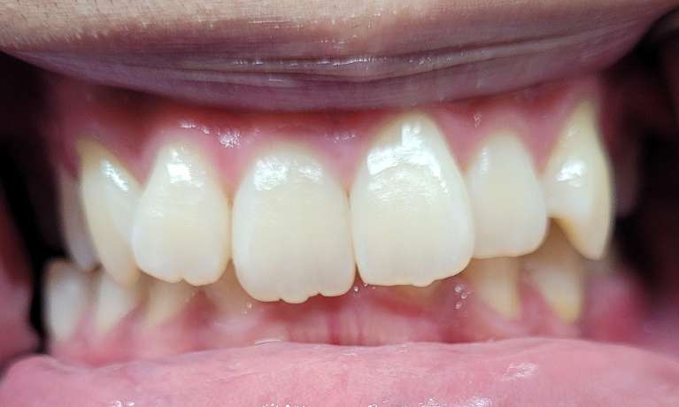 Spark-Before-Image